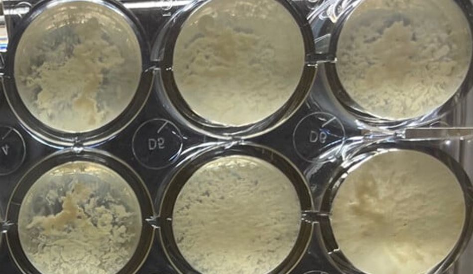 imageSurvie Microbienne