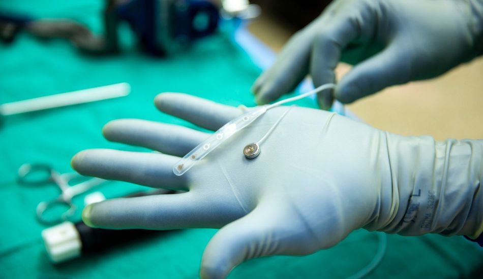 Technologie d'Implant